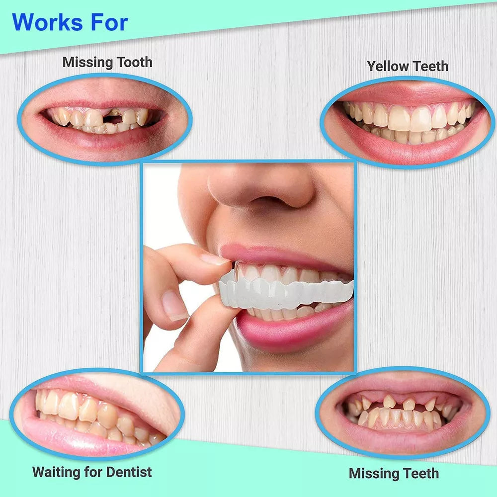 Instant Dental Veneer – Perfect Smile in Seconds