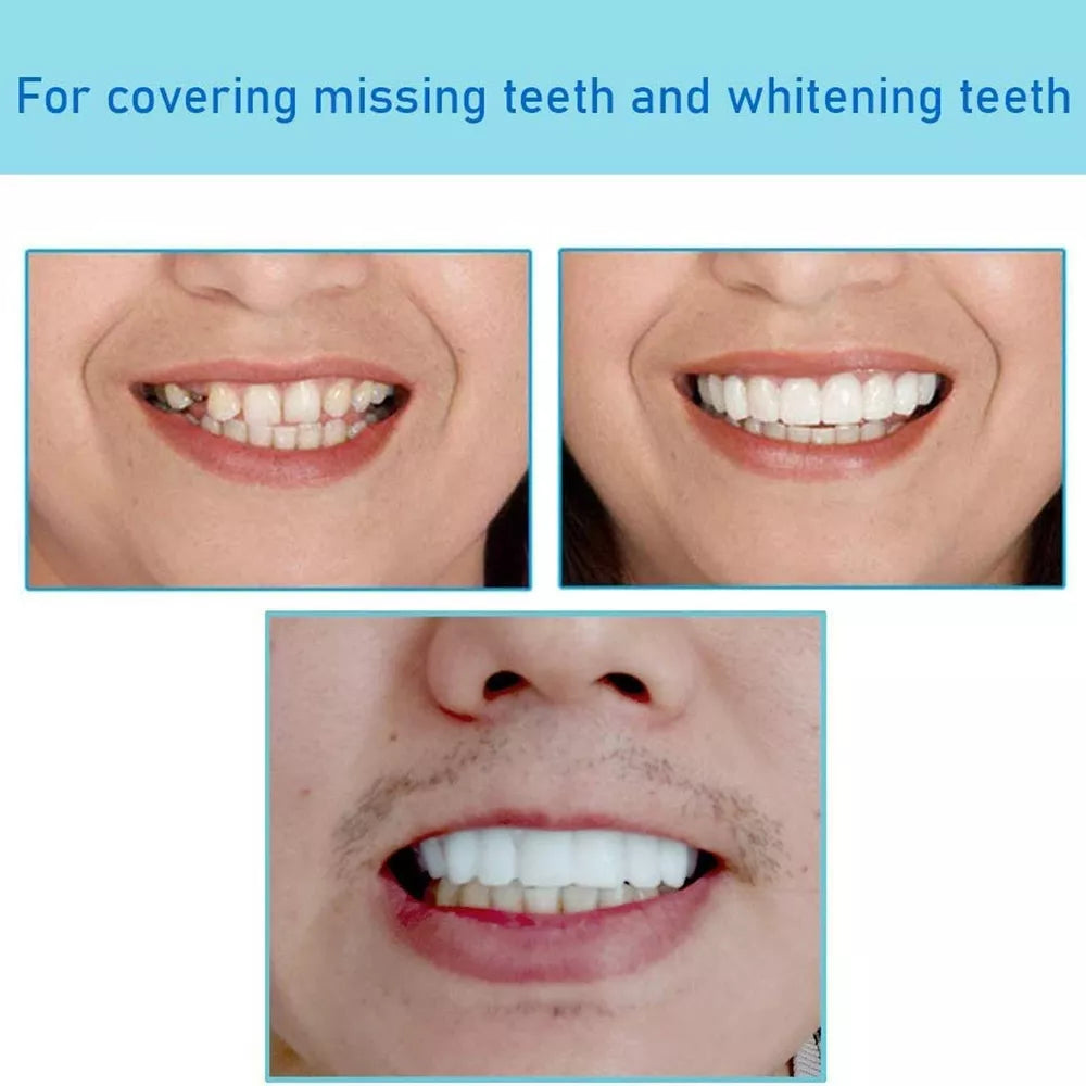 Instant Dental Veneer – Perfect Smile in Seconds