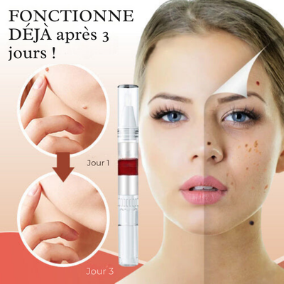 Natural Skin Tag and Wart Remover – Safe, Fast, and Effective Treatment