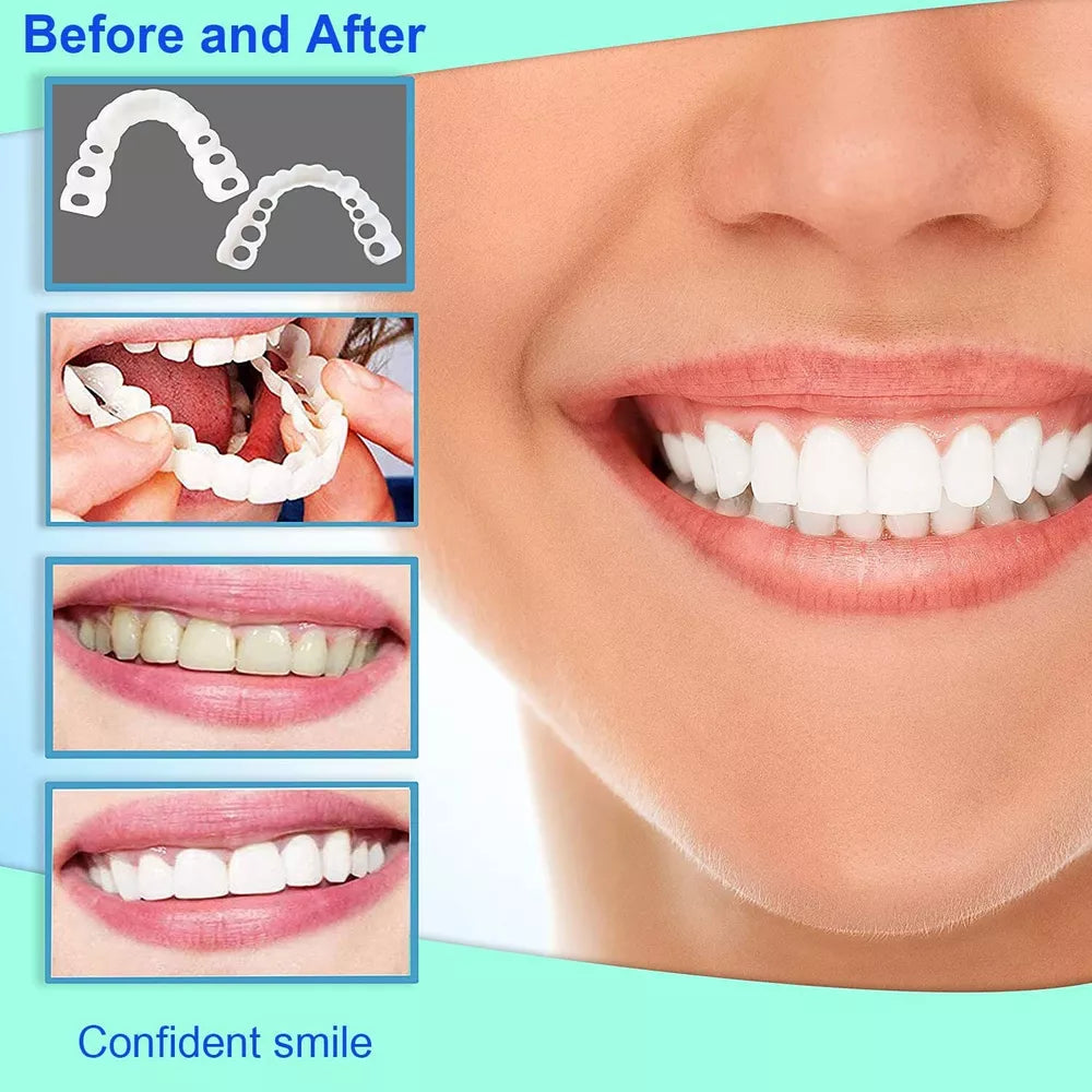 Instant Dental Veneer – Perfect Smile in Seconds