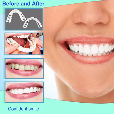 Instant Dental Veneer – Perfect Smile in Seconds