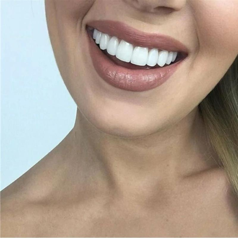BrightDent SnapFit – Instant White Smile, Effortlessly