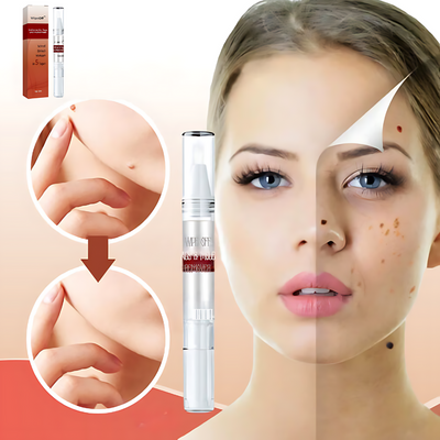 Natural Skin Tag and Wart Remover – Safe, Fast, and Effective Treatment