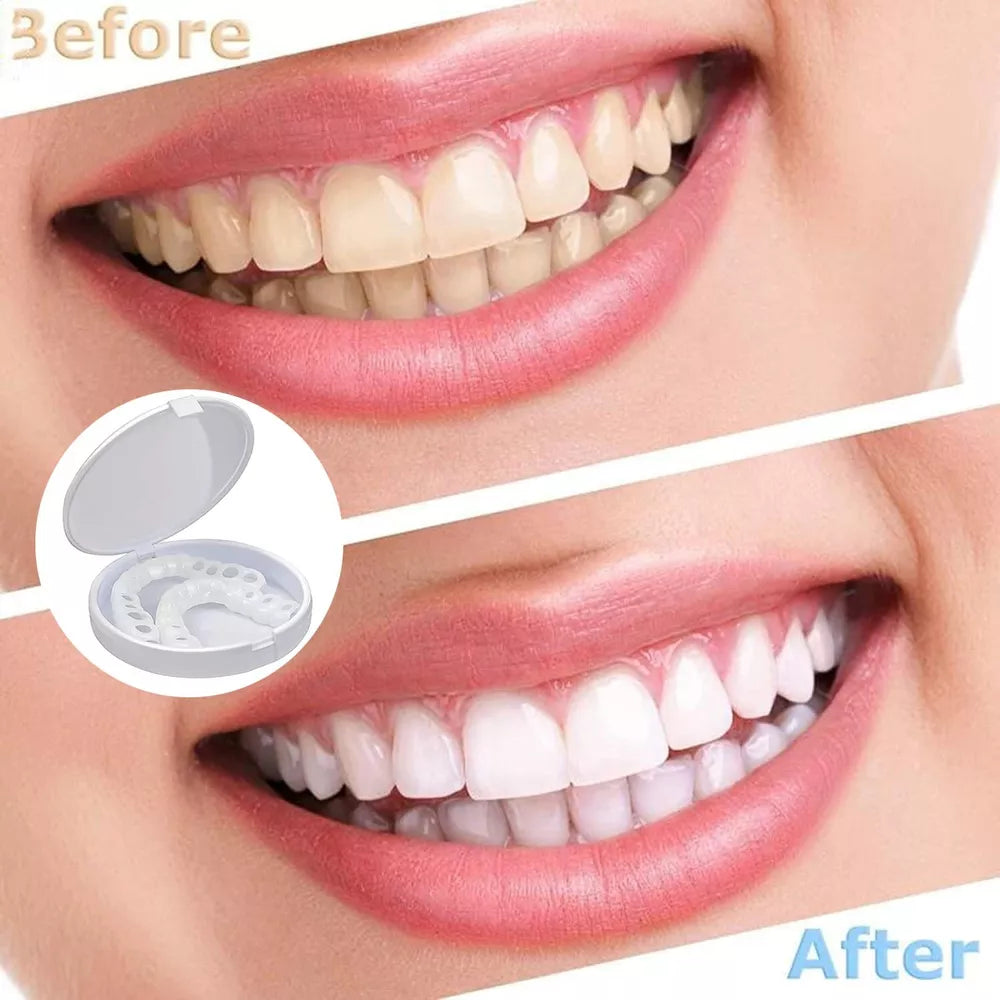 Instant Dental Veneer – Perfect Smile in Seconds