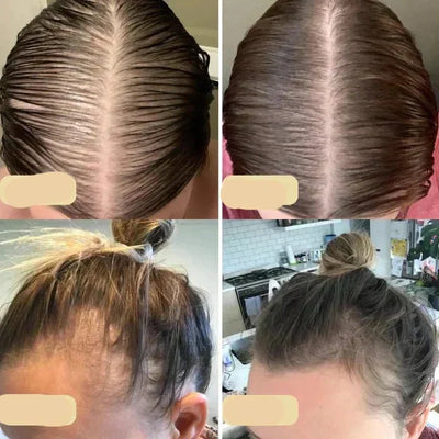 Natural Hair Growth Oil – Boost Thickness, Volume, and Shine