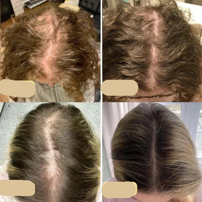 Natural Hair Growth Oil – Boost Thickness, Volume, and Shine