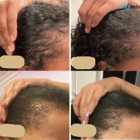 Natural Hair Growth Oil – Boost Thickness, Volume, and Shine