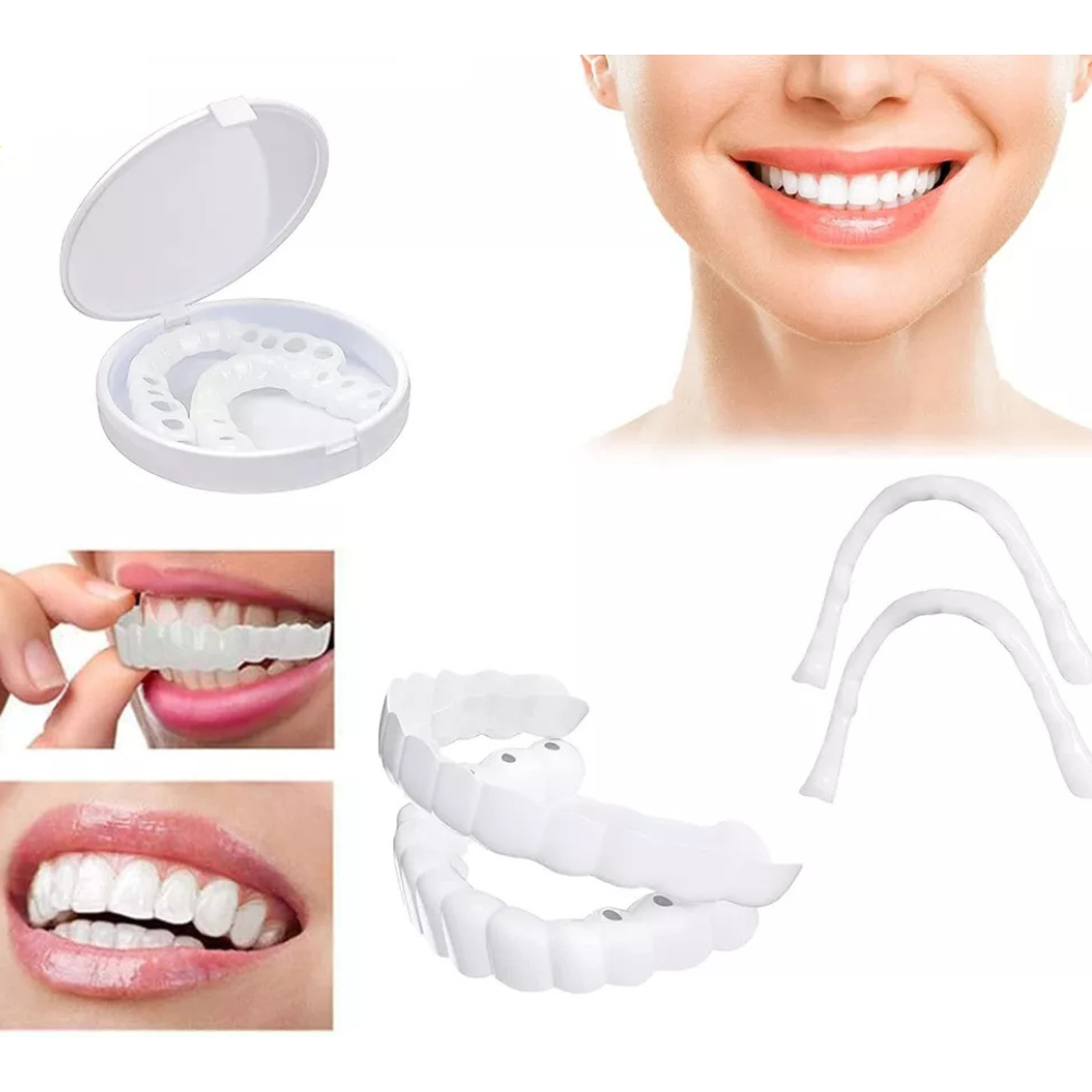 Instant Dental Veneer – Perfect Smile in Seconds